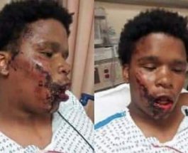 Афро-американский мальчик был избит