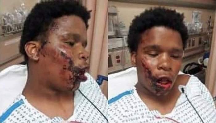 Афро-американский мальчик был избит