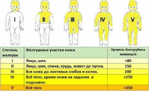 Трамп, желтая кожа, оранжевое лицо, билирубин,